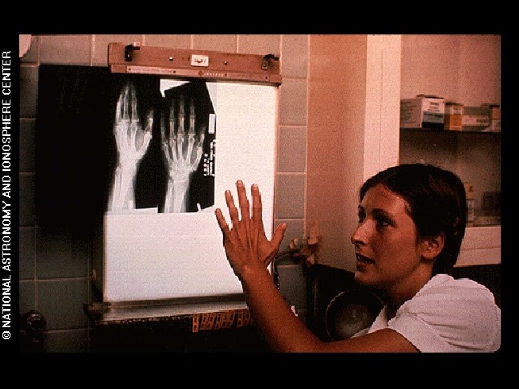 Фотографии на золотом диске «Вояджера». Рентген человеческой руки. Фото.