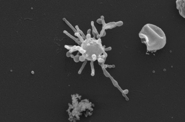Предок всей жизни на Земле, возможно, обнаружен — это микроб со “скелетом”. Фото.