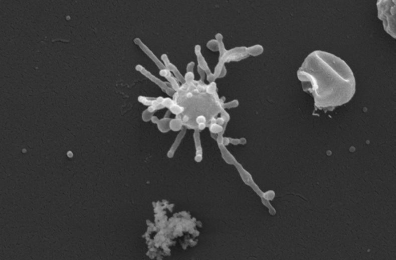 Предок всей жизни на Земле, возможно, обнаружен  это микроб со скелетом