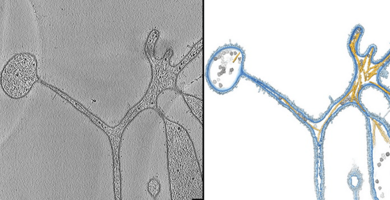 Древняя архея может управлять мембраной. «Щупальца» адгарского микроба под микроскопом. Фото.