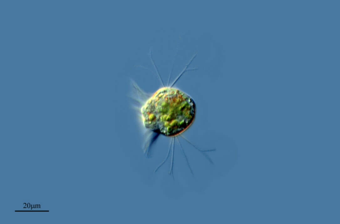 Организм, который питается вирусами. Хальтерия под микроскопом. Фото.