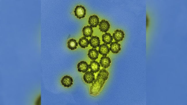 Симптомы свиного гриппа (А/H1N1). Свиной грипп под микроскопом. Фото.