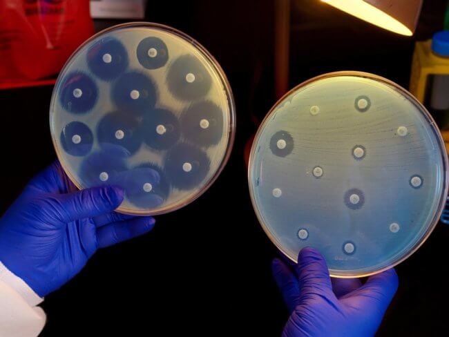 Контроль над супербактериями. Устойчивые к антибиотикам бактерии трудно поддаются лечению. Фото.