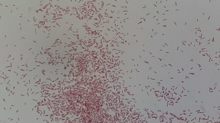 Могут ли бактерии путешествовать по организму. Супербактерии Pseudomonas aeruginosa могут мигрировать по организму, поражая разные органы. Фото.