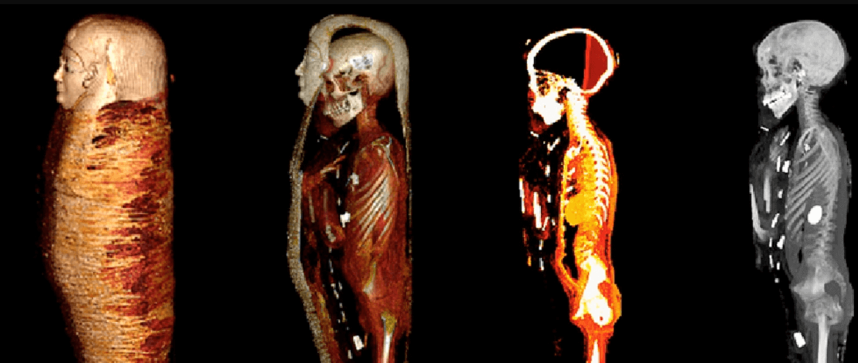 Саркофаг с древнеегипетской мумией оказался сокровищницей. Ученые исследовали мумию при помощи компьютерной томографии. Фото.
