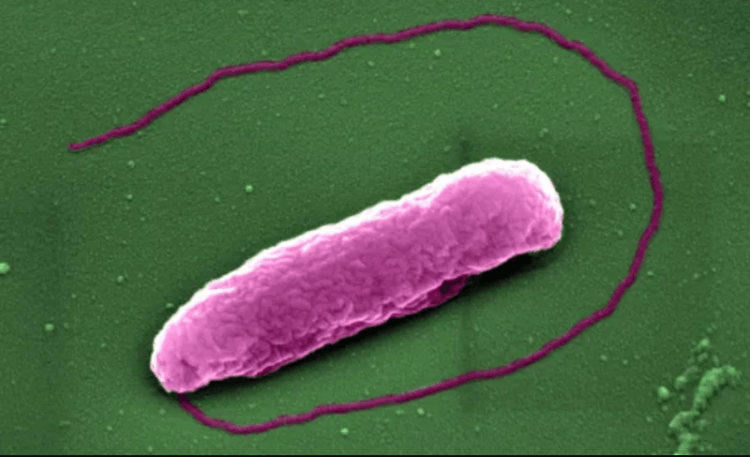 Как действуют генно-модифицированные бактерии. Супербактерия Pseudomonas aeruginosa, которая часто становится причиной летальных исходов. Фото.