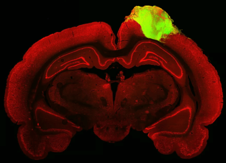Человеческий ограноид восстановил мозг крысы. Органоид успешно интегрировался в мозг грызуна. Фото.