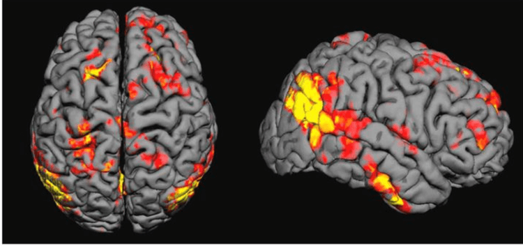 Как работает мышечная память. При помощи фМРТ ученые следили за активностью мозга добровольцев во время игры. Фото.