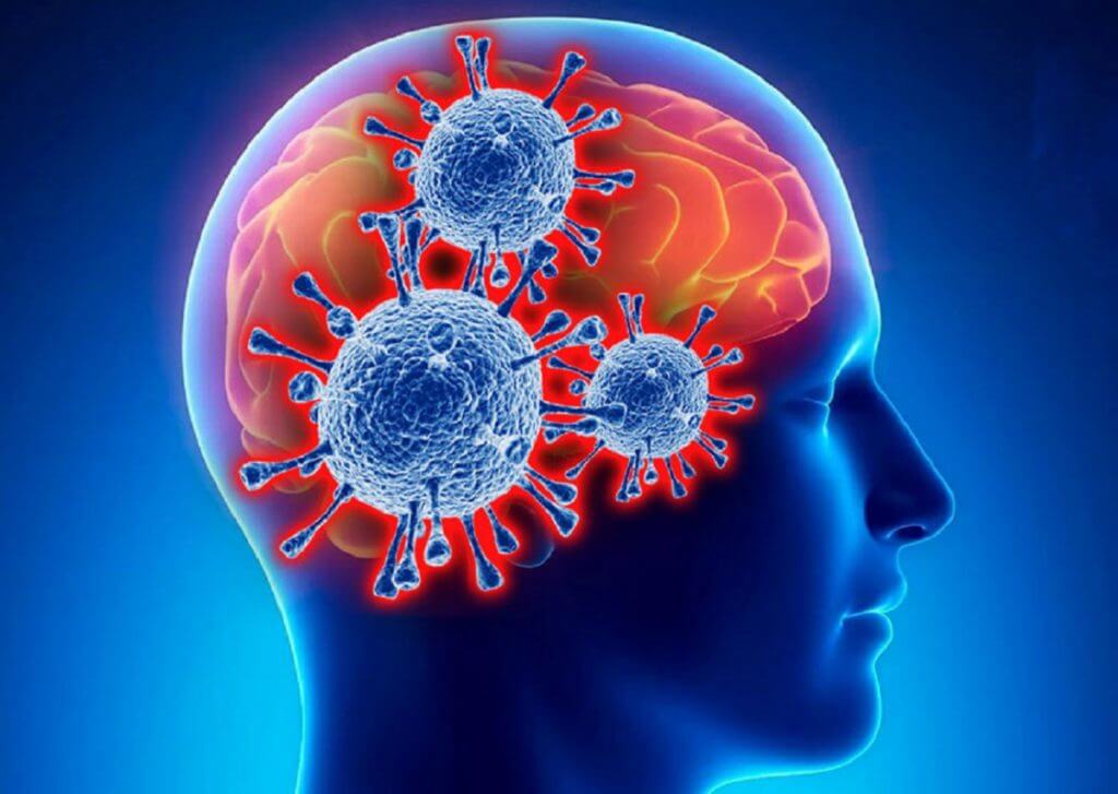 Синдром иностранного акцента может возникнуть после COVID-19? Коронавирус поражает головной мозг. Фото.