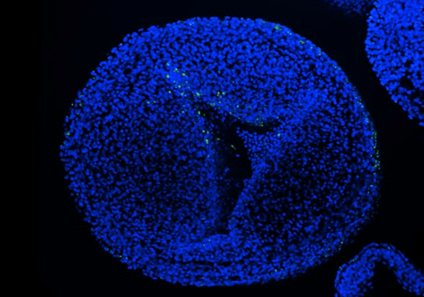 Как микропластик влияет на развитие эмбриона. Микропластик (зеленый) приклеивается к клеткам нервного гребня (синие). Фото.