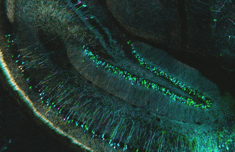 Как белок, который лечит депрессию, влияет на мозг? Ученые обнаружили, что в гипокампе мышей образовались новые нейроны. Фото.