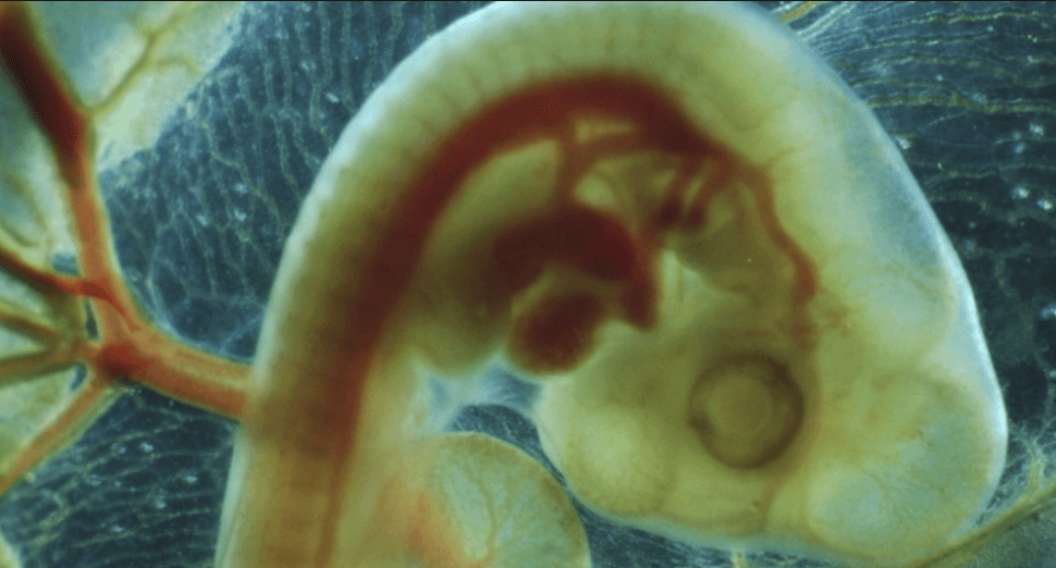 Ученые обнаружили новую ужасающую опасность микропластика. Ученые обнаружили, что микропластик влияет на развитие эмбриона. Фото.