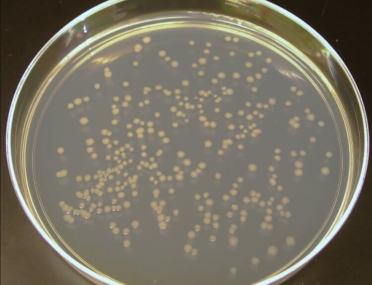 Опасность кишечной палочки. Штамм Escherichia coli O157:H7. Фото.