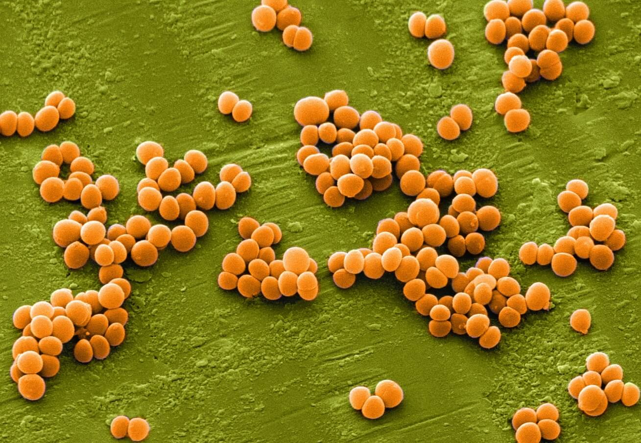 Бактерии на горе Эверест. Стафилококки под микроскопом. Фото.