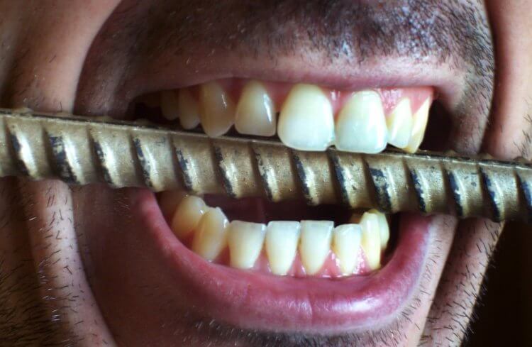 Почему зубы взрываются. Зубы — это одна из самых прочных частей человеческого тела. Фото.