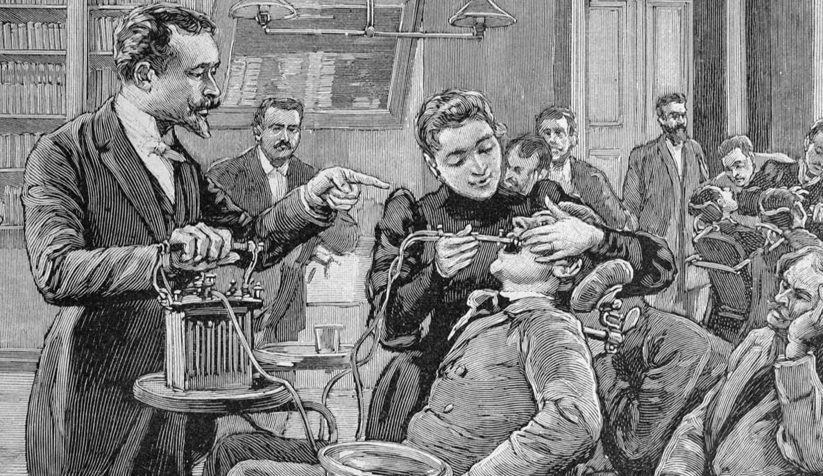 Почему зубы взрываются. Медицина 19 века была суровой, и ей было куда расти. Фото.