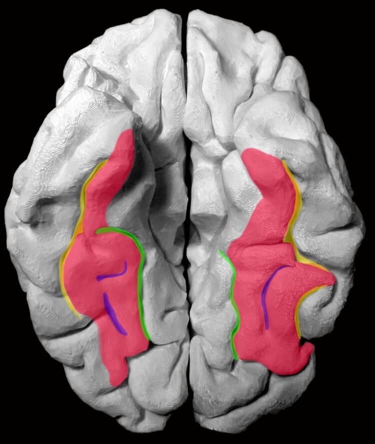 Приобретенная прозопагнозия. Веретенообразная извилина головного мозга человека. Фото.