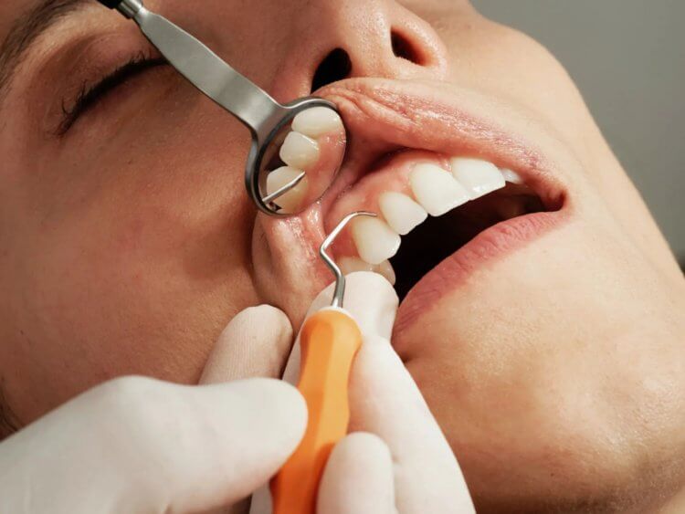 О каких проблемах со здоровьем говорят заболевания десен? Чистите зубы и пользуйтесь зубной нитью — ради вашего же блага! Фото.