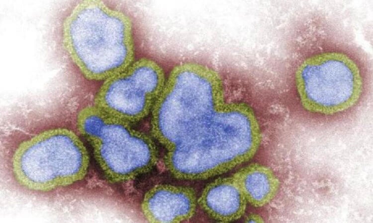 Птичий грипп может распространиться среди людей? Вирус птичьего гриппа H3N8 не способен передаваться от человека к человеку. Фото.