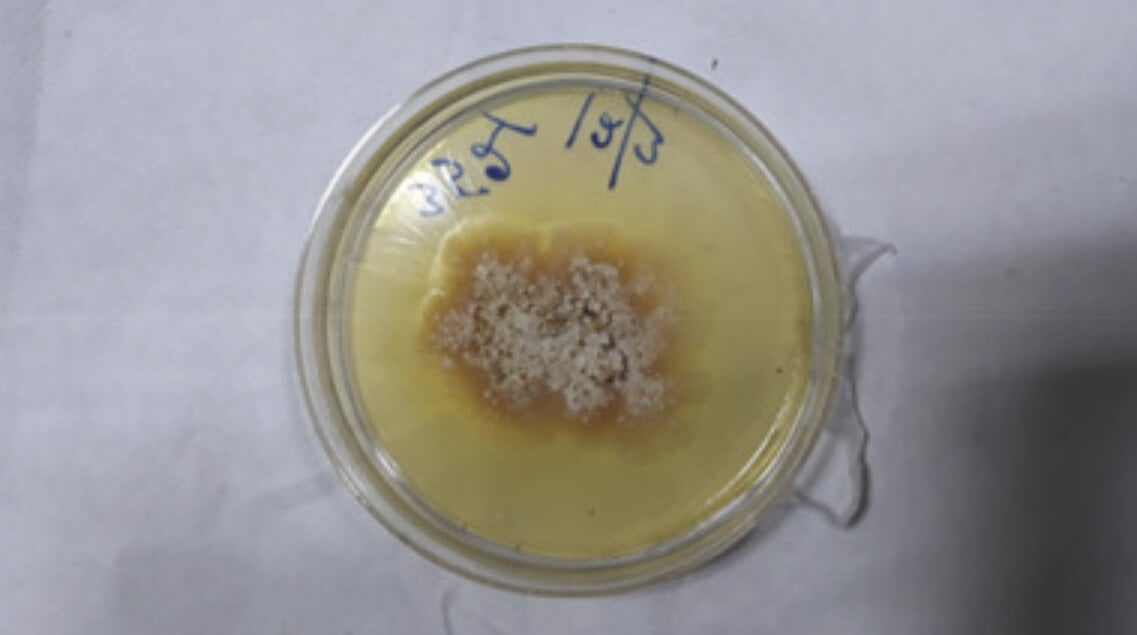 Новая грибковая инфекция человека. Грибок Chondrostereum purpureum. Фото.