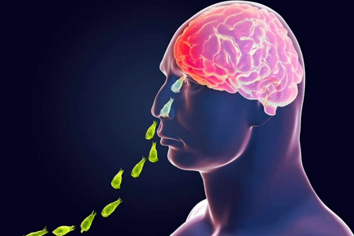 Амебное воспаление мозга может быть излечимо. Опасная амеба попадает в мозг через нос. Фото.