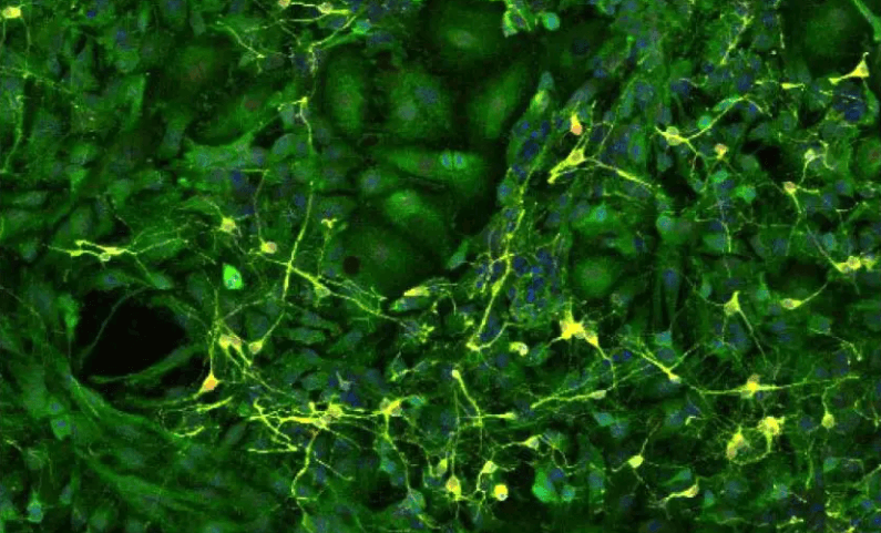 Как физические упражнения улучшают работу мозга. Нейроны мозга (желтые), окруженные астроцитами (зеленые). Фото.