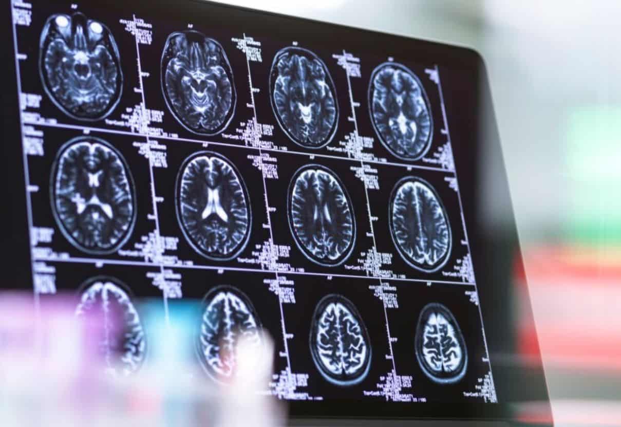 Влияние цифровых технологий на мозг молодых людей. С помощью фМРТ-сканирования ученые получают важнейшие данные о работе и функциях мозга. Фото.