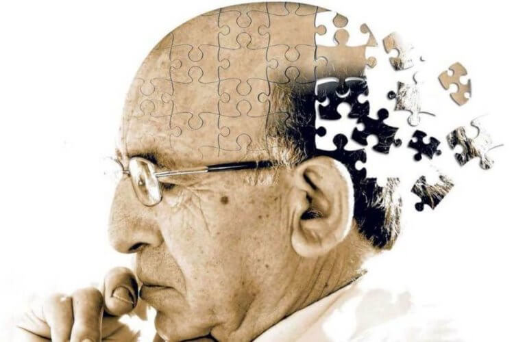 Болезнь Крейтцфельдта-Якоба. Ученые: болезнью Альцгеймера можно заразиться. Фото.