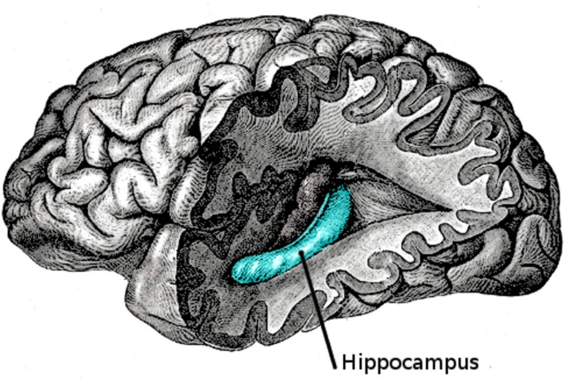 Последствия болезни Альцгеймера. Расположение гиппокампа в головном мозге. Фото.