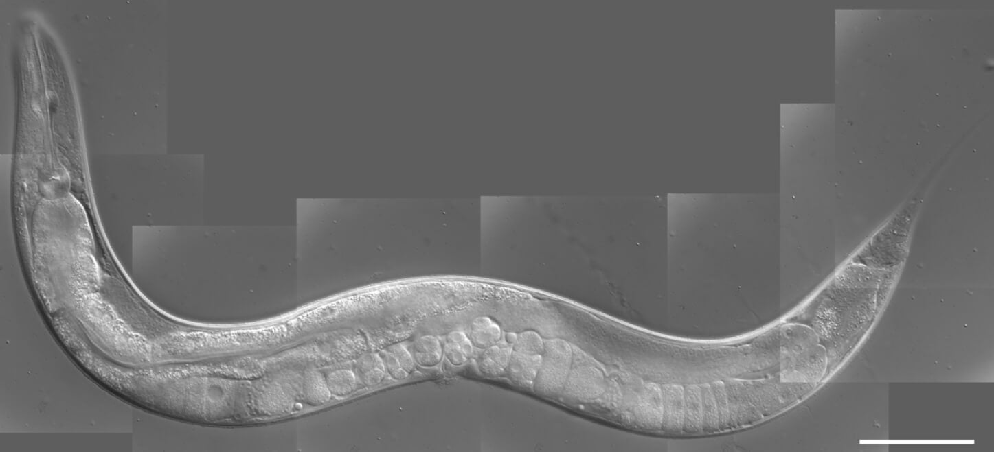 Средиземноморская диета продлевает жизнь. Ученые смогли увеличить длительность жизни червей Caenorhabditis elegans изменив их рацион питания. Фото.