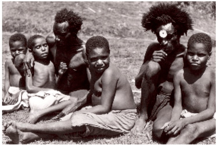 Прионы – необычные белки. Впервые эпидемическая инфекционная болезнь под названием куру была выявлена в 1950-х годах в племени Форе Папуа-Новой Гвинеи. Фото.