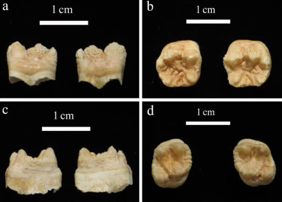 Лечение ртутью в древности. Поврежденные ртутью зубы древнего ребенка. Фото.