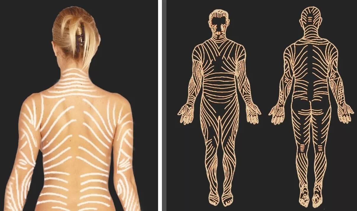 На теле человека есть полосы как у тигров, но они видны только в редких случаях. На теле каждого человека имеются линии — среди них есть невидимые, которые вызывают у ученых много вопросов. Фото.