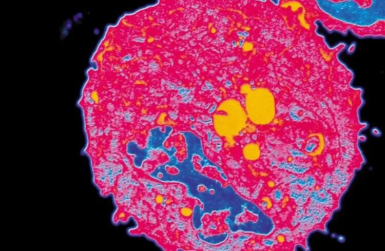 Новый взгляд на онкологические заболевания: что такое паразитарная теория рака? Крайне необычная но не новая теория онкологических заболеваний гласит, что рак – это ни что иное, как паразит. Фото.