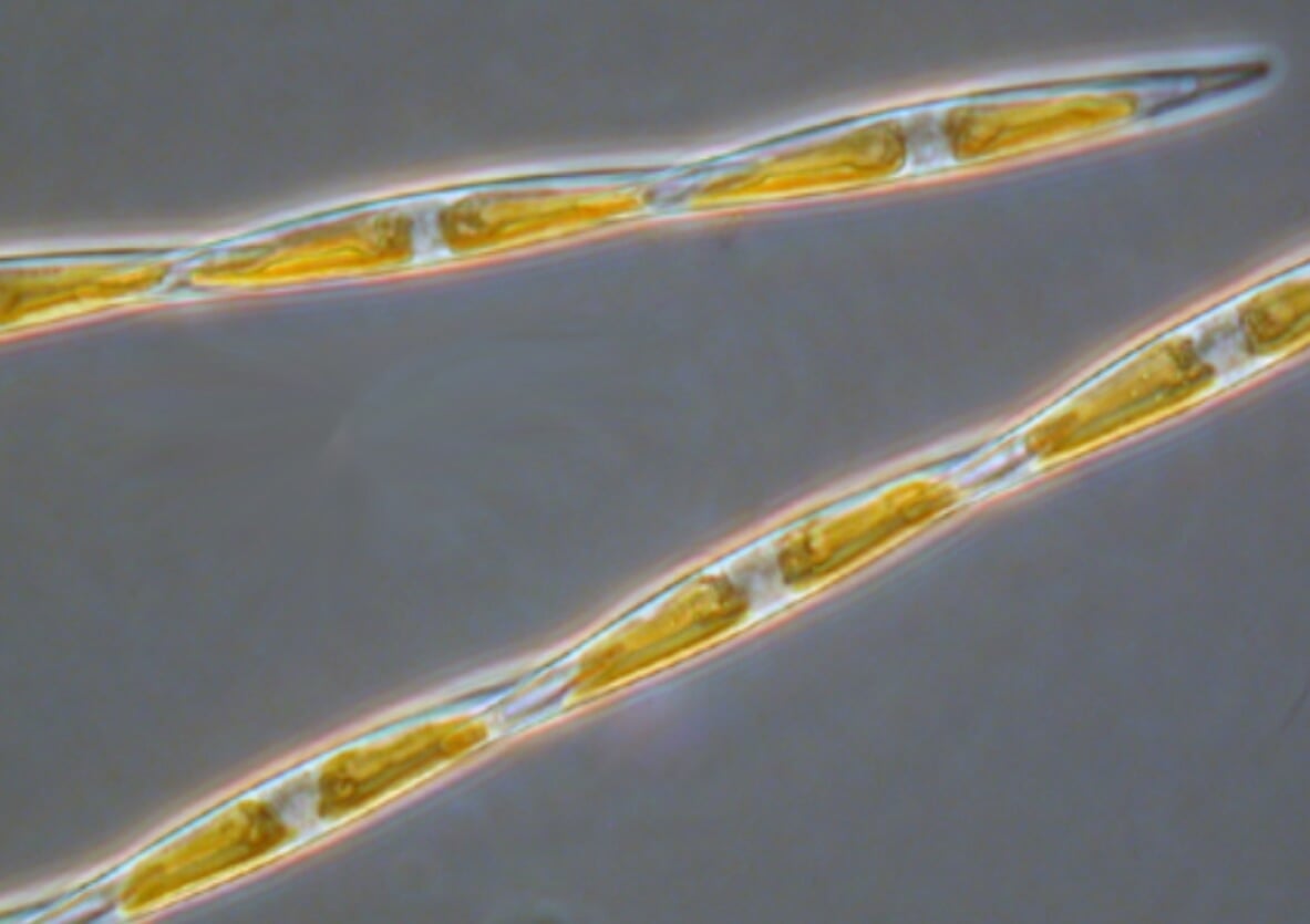 Чем опасны водоросли. Водоросли Pseudo-nitzschia под микроскопом. Фото.