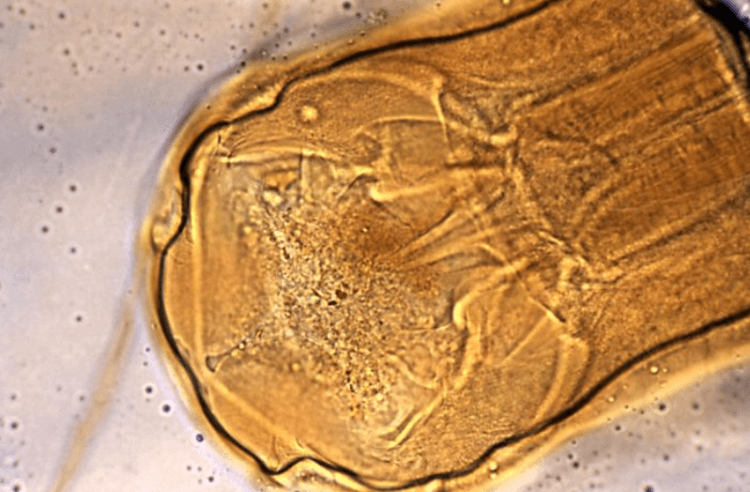 Как паразит может защитить людей от диабета. Голова червя Necator americanus под микроскопом. Фото.