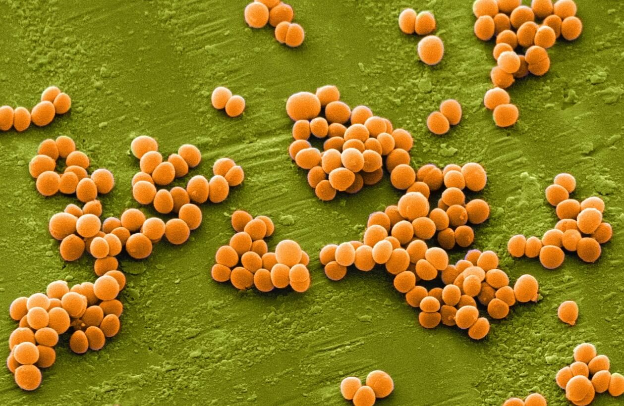 Какие бактерии живут на смартфонах. Стафилококк под микроскопом. Фото.