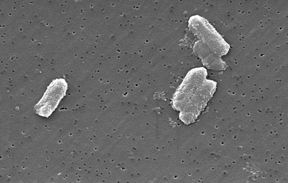 Какие бактерии живут на смартфонах. Цитробактеры под микроскопом. Фото.