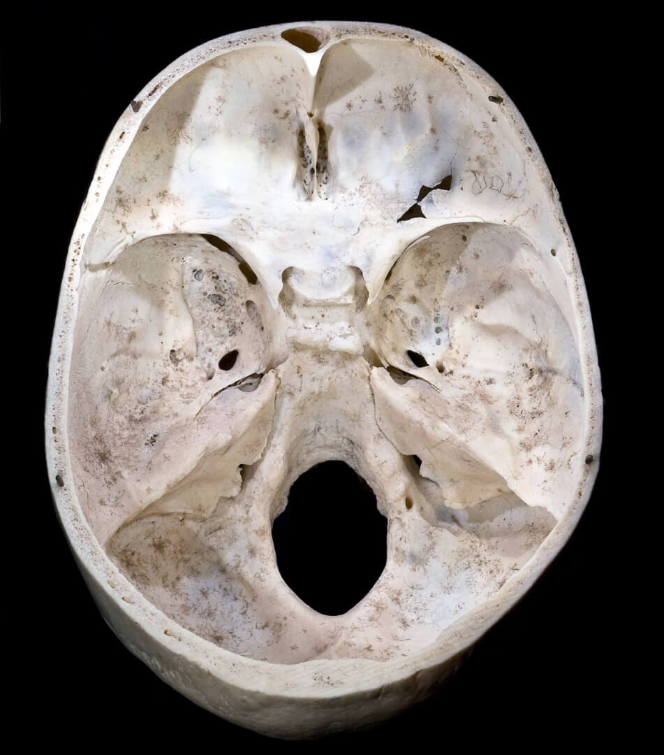 Строение черепа человека. Посередине находится большое затылочное отверстие черепа. Фото.