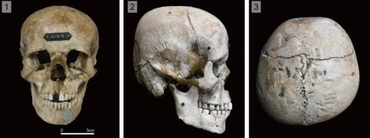 Тайна племени Хирота из острова Танегасима. Деформированные черепа, найденные на острове Танегасима. Фото.