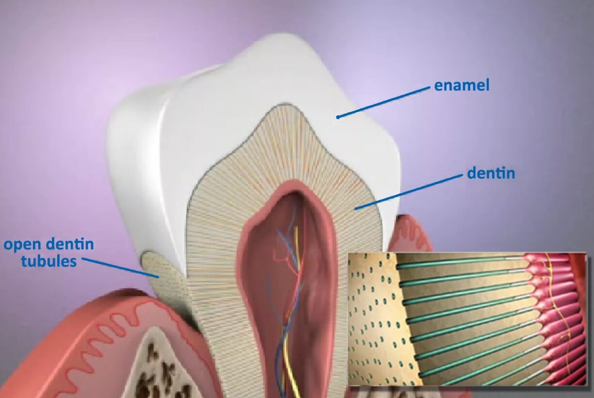 Как вегетарианство влияет на зубы. Эмаль и дентин зуба. Фото.
