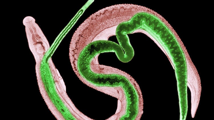 Какие редкие паразиты могут жить в теле человека? Недавно из мозга жительницы Австралии извлекли живого круглого червя. Эта жуткая история, однако, не единственная в своем роде. Фото.