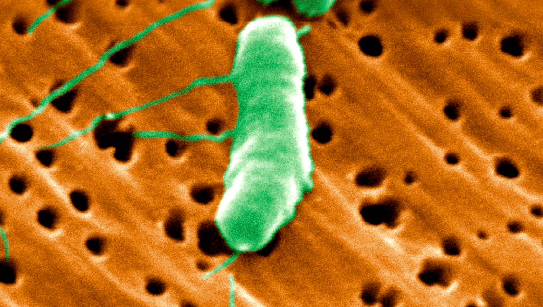 Как можно заразиться вибрионами. Плотоядная бактерия поражает ткани человека. Фото.