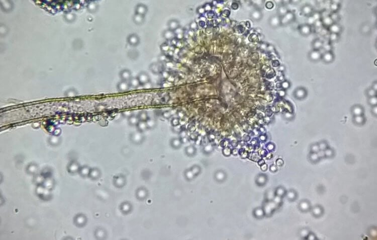 Чем опасны гнилые продукты. Грибок Aspergillus flavus под микроскопом. Фото.