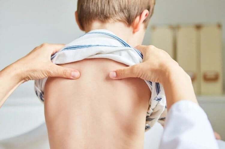Что такое синдром фиксированного спинного мозга. К счастью, диагностированный у мальчика синдром поддается лечению. Фото.