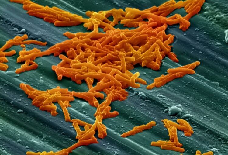 Бактерии на грязной обуви. Бактерий Clostridium difficile в обувной подошве больше, чем в унитазе. Фото.