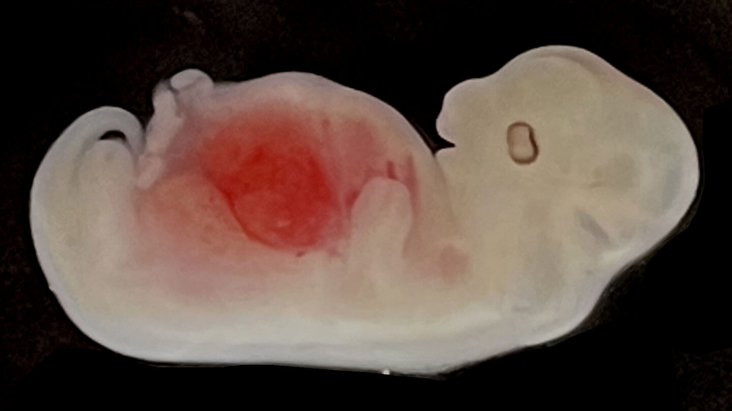 Эксперимент на грани биоэтики: ученые вырастили аналог человеческой почки внутри гибридного эмбриона. Исследователи вырастили аналог почки человека в эмбрионе свиньи. Фото.