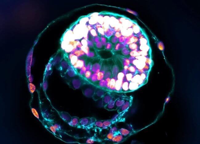 Ученые вырастили полную модель человеческого эмбриона, неотличимую от настоящего. Фото.