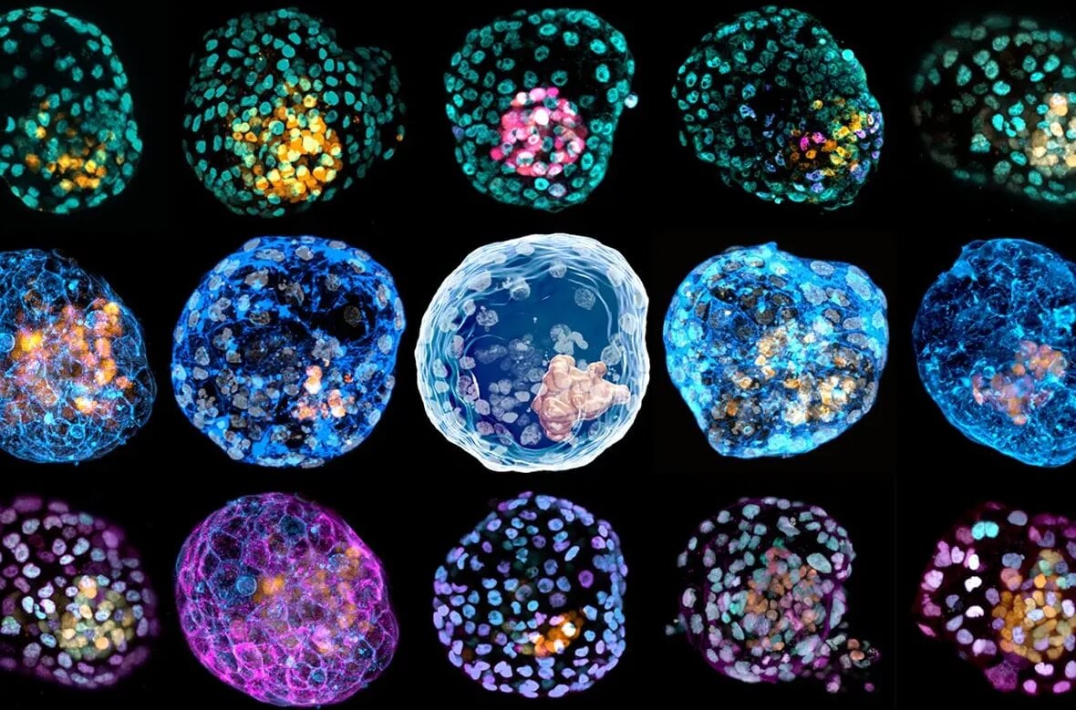 Как ученые создали аналог человеческого эмбриона? Ученые создают модели эмбрионов для того, чтобы изучать самые первые дни после зарождения новой человеческой жизни и делать это наиболее этически приемлемым способом. Фото.