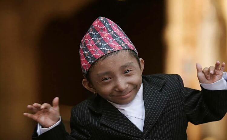 Хагендра Тапа Магар — самый маленький человек в мире. Человек с самым маленьким ростом — Хагендра Тапа Магар. Фото.